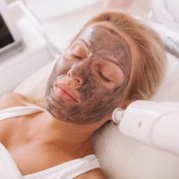 Hollywood Peel
